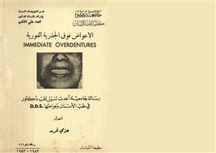 الأعواض فوق الجذرية الفورية -طب أسنان